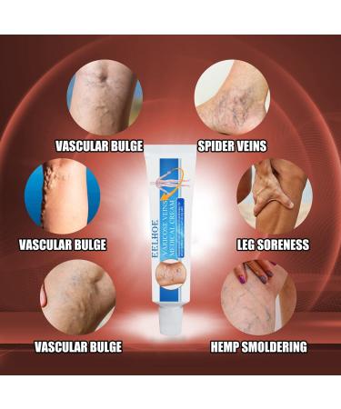 6-Piece Anti-Varicose Veins Cream & Spray Set - Soothing Relief for Tired Legs - Reduces Appearance of Varicose Veins - Buy Online on GoSupps.com