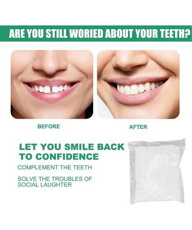 50g Tooth Solid Gel Temporary Repair Kit - Degradable Thermoplastic Beads for Replacement Teeth Filling - Fix Broken or Missing Teeth - Buy Online on GoSupps.com