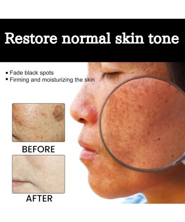 Melanins Correcting Cream Moisturizing Repair Creams Natural Facial Moisturizer Brightening Body Cream Efficient Whiten Cream Even Skin Tone and Hydration for All Skin Types - Buy Online on GoSupps.com