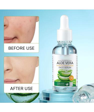 Rust sheet essence liquid aloe essence liquid moisturizing aloe essence liquid deeply replenishes water lightens and nourishes the skin fades acne marks - Buy Online on GoSupps.com