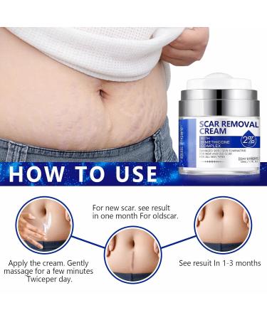Scar Removal Cream - Natural Scar Repair for Acne Stretch Marks & More | Effective for Old & New Scars on Face & Body - Buy Online on GoSupps.com