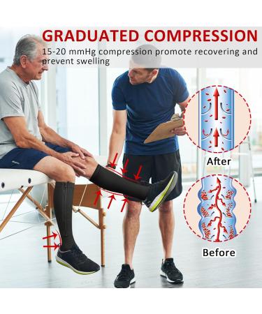 Ailaka Open Toe Compression Socks 15-20 mmHg for Men & Women - Knee High Support for Varicose Veins, Edema, Pregnancy - L/XL Black (1 Pair) - Buy Online on GoSupps.com