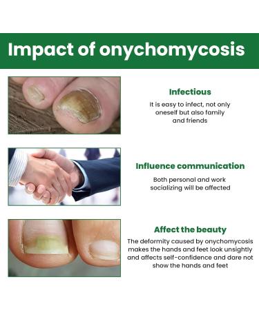 MrCuvaryas Nail Serum for Toenails Extra Strong - Buy Online on GoSupps.com