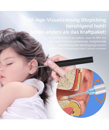 AVM WiFi Wireless Ear Wax Removal Kit - 1080P FHD Ear Camera 8 Ear Picks App Control IP67 Waterproof for Adults Kids & Pets (White - Buy Online on GoSupps.com