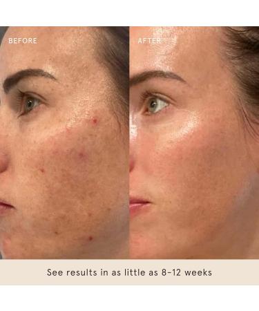 Barefaced Core Four - Original Toning Pads Liquid Gold RetinAL Tinted SPF - the Foundation for Healthy Skin - Buy Online on GoSupps.com