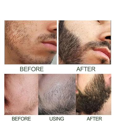 East Moon Beard Shaping Pen 2PC Set | Beard Growth Serum Oil & Roller | Best Gift for Men - Buy Online on GoSupps.com