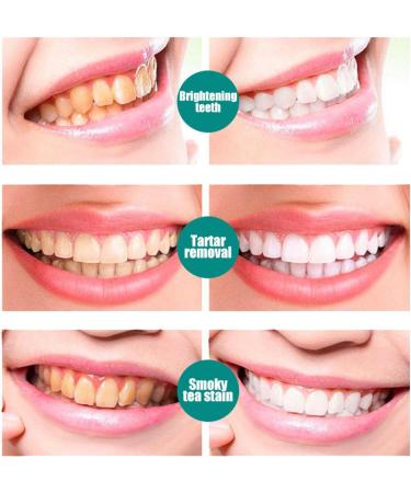 White Teeth Mousse - Intensive Stain Removal Tooth Foam | 60ml Easy-To-Use Whitening Solution - Buy Online on GoSupps.com