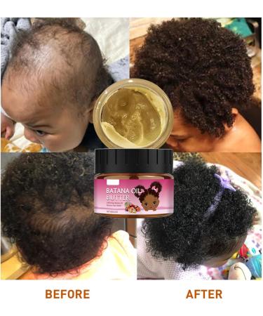 Les Huiles De Batana Pour La Croissance Des Cheveux REGROWTH Traitements Repousse Renforcent Le Cuir Chevelu Am liorer Circulations Sanguines Du Beurre D'huile Batana Pour La Croissance - Buy Online on GoSupps.com