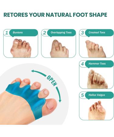 Welnove 8 Pack Toe Separators Bunion Corrector for Women/Men Toe Spacers Foot Alignment - Dividers to Correct Bunions Hammertoes Relief Restore Feet (Blue) - Buy Online on GoSupps.com