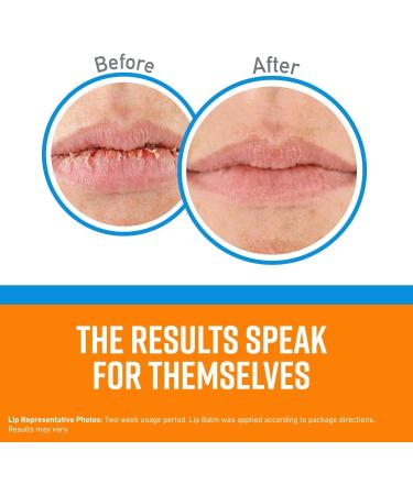 O'Keeffe's Lip Repair No Scent Lip Balm 0.15 oz - Moisturizing Long-Lasting Lip Care for All Skin Types - Buy Internationally - Buy Online on GoSupps.com