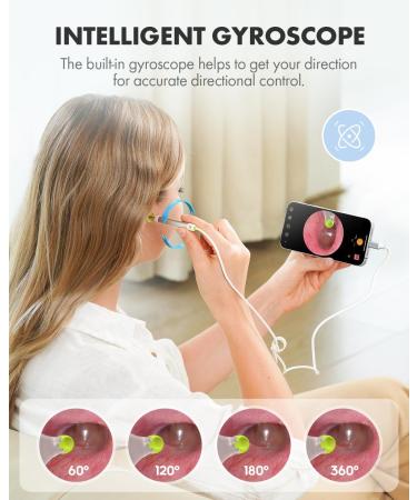 Anykit Digital Otoscope - HD Ear Camera with Gyroscope & Wax Removal Tools Compatible with iPhone 15 & Android - Clear Video Scope (Silver - Buy Online on GoSupps.com