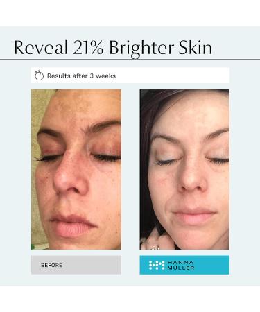 Kojic Acid Serum for Face - 2% Pure Kojic Acid with Ferulic Acid, Aloe Vera, Vitamin E - Skin Brightening Formula for Dark Spots, Discoloration, Hyperpigmentation - Buy Online on GoSupps.com