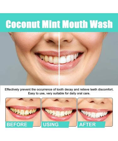 Oralhoe Coconut Mint Mouthwash | Mint Oil Pulling with Tongue Scraper | Fresh Breath - 2 Pcs | International Shipping - Buy Online on GoSupps.com