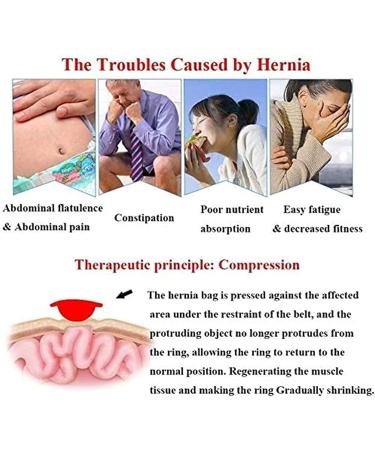 Samnuerly Inguinal Hernia Support | Post-Operation Pain Relief Truss Bandage | Breathable Single/Double-Strip Sports Hernia Solutions - Shop Now! - Buy Online on GoSupps.com