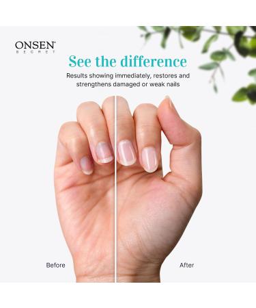 Onsen Secret Cuticle Cream + Nail File Set - Japanese Healing Minerals for Nail Care | Repair, Strengthen & Soothe Cuticles & Nails - Non-Greasy Serum & 120/180 Grit File - Buy Online on GoSupps.com