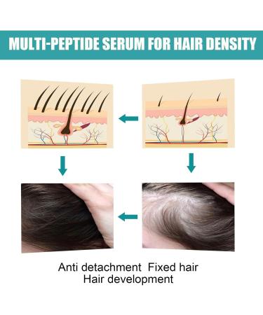 Multi-Peptide Hair Density Serum The Original Ordinary Hair Growth Serum for Men and Women Multi-Peptide Serum for Volume Of Hair Vegan Hair Growth Serum Designed for Thinning Hair & Hair Loss - Buy Online on GoSupps.com