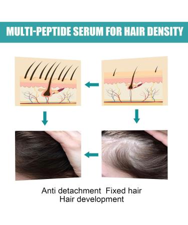 Buy The Ordinary Hair Growth Serum for Men & Women | Vegan Multi-Peptide Formula for Thinning Hair & Volume - 60ml - Buy Online on GoSupps.com