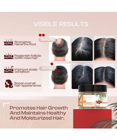 SADOWAY Batana Oil for Hair Growth Organic Oil to Prevent Hair Loss & Moisturize Scalp for Men & Women - International Shipping Available - Buy Online on GoSupps.com