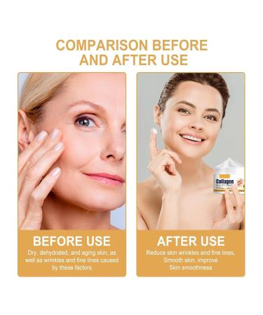 futiu Collagen Moisturizing Cream - Reduces Fine Lines Boosts Elasticity Long-Lasting Hydration Brightens Dull Skin(2pcs) - Buy Online on GoSupps.com