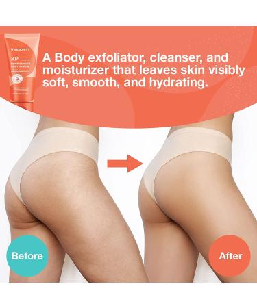 KP Bump Eraser Body Scrub - Exfoliating Strawberry Legs Treatment for Women & Men - 8.45oz - Buy Online on GoSupps.com