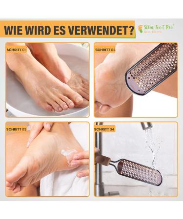 Professional Stainless Steel Corneal Remover Set for Effective Foot Care | Remove Dead Skin Calluses & Cracked Feet - Buy Online on GoSupps.com