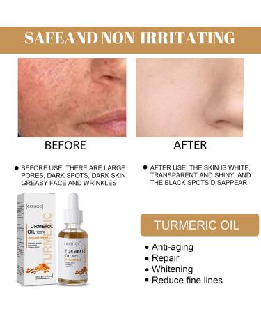 Turmeric Face Serums Oil Turmeric Serum Bright Skin Dark Spot Corrector Turmeric Essence Oil for Moisturizing Anti Aging Serum for Face Anti-aging Facial Bright Skin Oil 30ML - Buy Online on GoSupps.com