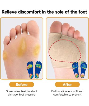 Metatarsal Pads Gel Sleeves Cushions - 1 Pair for Women and Men - Ball of Foot Cushion Fabric Socks - Supports Feet Pain Relief - Large (UK 6-11) - Buy Online on GoSupps.com