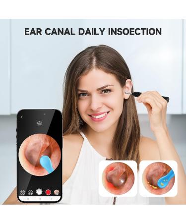 Ear Wax Removal GuardWee Ear Cleaner with Camera and Light | 6 Pcs Ear Pick Set | Ear Cleaning Kit | 1440P HD Camera | Black - Buy Online on GoSupps.com