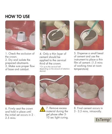 Buy ESTEMP Permanent Dental Cement for Caps Crowns Bridges Inlays Onlays Implants & Veneers - Fast International Shipping - Buy Online on GoSupps.com