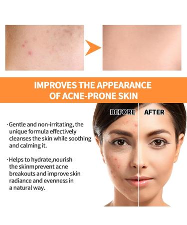 Turmeric Mud Mask Stick - Deep Cleanse Blackhead Removal & Radiant Glow for All Skin Types | International Shipping - Buy Online on GoSupps.com