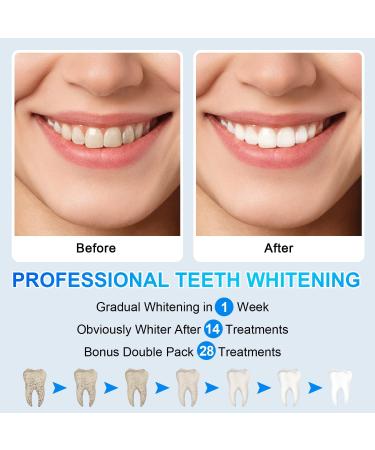 Teeth Whitening Strips - 56 Strips, 28 Treatments Kit for Sensitive Teeth, Dental Whitener to Remove Stains - Non-Slip White Strips - Buy Online on GoSupps.com