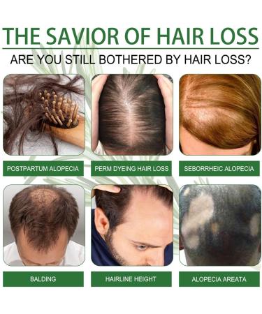 General Hair Essence Oil | Deep Nourishing Treatment for Dry Hair & Scalp - 2.02 fl. oz Hair Care Solution - Buy Online on GoSupps.com