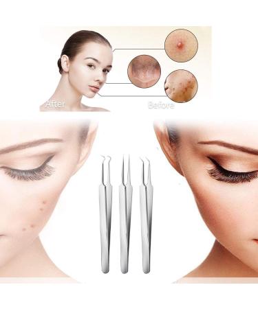 Blackhead Remover Kit Curved Tweezer Blackhead Removal Tools Spot Remover Tools Professional Pimple Comedone Extractor Zit Popper for Nose Face (silver) - Buy Online on GoSupps.com