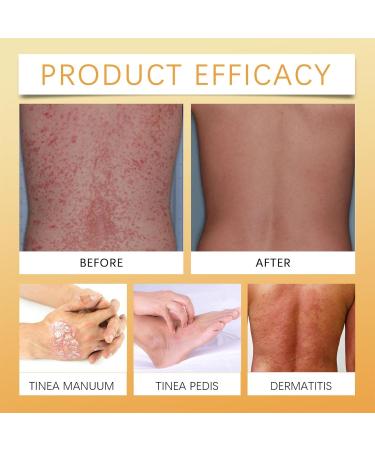 Body Hydrating Cream 50ml Beeswax Body Cream natural body moisturizer for sensitive skin moisturizing cream Easy to Absorb Cream Lightweight Skin Care Cream - Buy Online on GoSupps.com