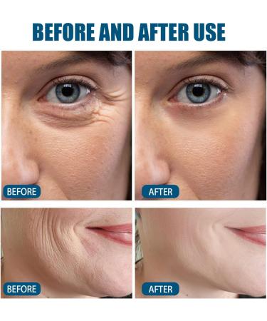 Highly Moisturizing Facial Essence Mineral 89 Hyaluronic Acid Face Serum Facial Gel Moisturizer and Pure Hyaluronic Acid Moisturizing and Hydrating Serum for Sensitive Skin and Dry Skin - Buy Online on GoSupps.com