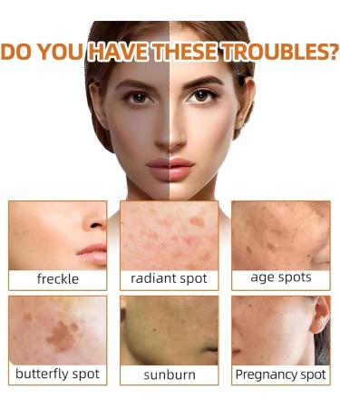 KQLULU 2Pcs Lemon Turmeric Kojic Acid Soap Bar Turmeric Brightening Soap Turmeric Moisturizing Soap Organic Turmeric Soap Bar For Face & Body Smooth Skin Fades Freckles - Buy Online on GoSupps.com