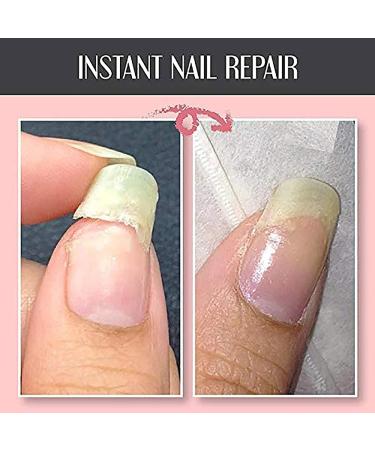 2024 Nail Repair Protection Gel Mottled Nail Repair Protection Gel Nail Treatment Repair Gel Instant Nail Protect Gel Nail Strengthener Instant Cracked Nail Repair Gel Quick Fix Nail Repairer (1pcs) - Buy Online on GoSupps.com