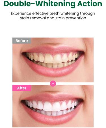 EUTHYMOL Whitening Toothpaste (3.7fl oz) - Stain Removal in 2 Weeks Long-Lasting Freshness for Sensitive Gum & Teeth. Bad Breath Cavity Prevention. Recyclable Aluminum Tube Pack of 1 - Buy Online on GoSupps.com