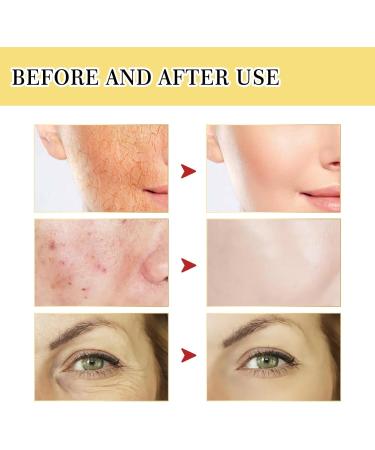 Snail Mucin Essence - Hyaluronic Acid Serum for Face for Hydrated - Revitalize Moisturize and - Anti Aging Serum Targets Fine Lines & Wrinkle - Firming and Plumping of Skin All Skin Types - Buy Online on GoSupps.com