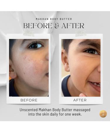 Organic Mahkan Whipped Body Butter 8 oz Jar | Airy & Nourishing Formula | Essential Oil Scents & Unscented Option | Non-Greasy Deeply Hydrating Organic & Natural Ingredients Honeysuckle Jasmine Orchid Neroli 8 Ounce (P  - Buy Online on GoSupps.com