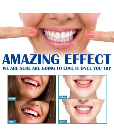 Teeth Whitening Pen (2 Packs) Natural Gel Treatment - Safe, Effective, Painless Whitener - Removes Years of Stains - Travel-Friendly - Buy Online on GoSupps.com