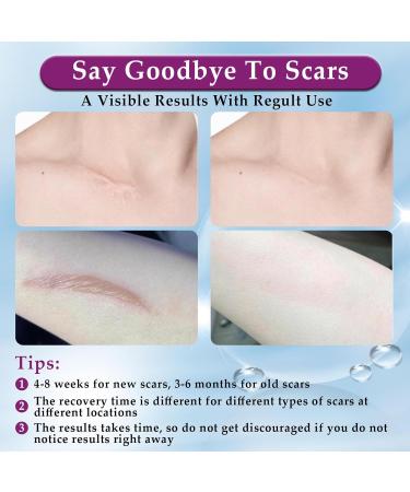 Eveellyn Scar Cream 1.7 oz - Professional Gel for Surgical, Stretch Mark, Keloid, C-Section, Burn, Acne & Old/New Scars Removal - Buy Online on GoSupps.com