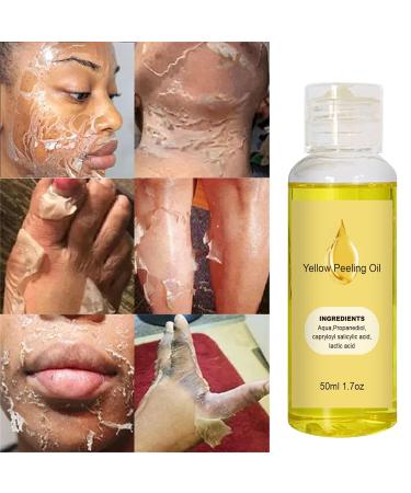 Exfoliant Yellow Peeling Oil - Extra Strong Chemical Exfoliant for Face & Body Reduces Rough Skin & Dullness Removes Dead Skin Cells - Buy Online on GoSupps.com