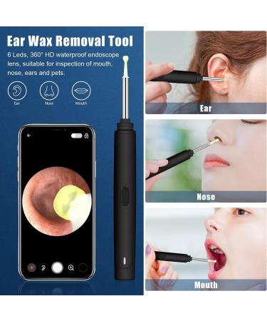 NANANARDOSO Wireless Ear Wax Removal Camera with 1080P HD Endoscope Otoscope - 6 LED Lights, 6 Ear Spoons, Compatible with iPhone, iPad, Android Phones - Buy Online on GoSupps.com