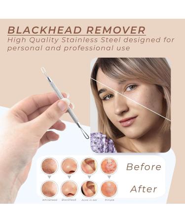 OCBA Blackhead Remover Professional Skincare Spot Treatment Blackhead Remover Tool for Blemish Comedone Whiteheads Pimple Popper with Double Sided Soft Touch and Anti-Slip Design - Buy Online on GoSupps.com