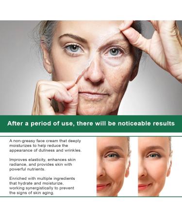  JPSDOWS Whitening Cream Underarm Whitening Cream for Women 100ml Intimate Lightening Gel for Body Face Bikini and Sensitive Areas and Specific Lightening - Buy Online on GoSupps.com