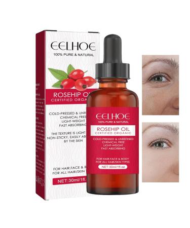 Cold-Pressed Rosehip Oil for Face | Nourishing Moisturizer for All Skin Types | 30ml Essential Oil for Skin Hair & Nails - Buy Online on GoSupps.com