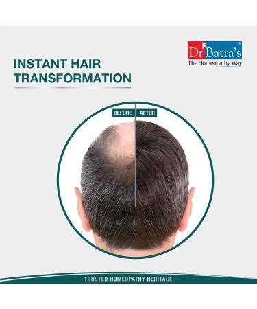 Dr. Batra's Instant Hair Keratin Fibres - Dark Brown 12g | Natural Hair Building Solution for Instant Volume | International Shipping Available - Buy Online on GoSupps.com