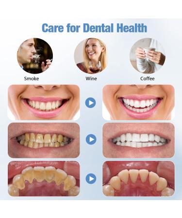 Wagner Stern Teeth Whitening Kit: 5 Modes Plaque Remover for Teeth Stain Removal - Dental Plaque Tool with 2 Heads - Buy Online on GoSupps.com