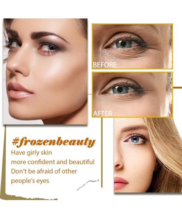 10% Lactic Acid Serum + Hyaluronic Acid Serum Vitamin C Serum Lactic Acid 10% Serum Anti Aging Serum Lactic Acid Pore Minimizer Serum Hyaluronic Acid Moisturiser Hydrating Serum for All Skin Types - Buy Online on GoSupps.com